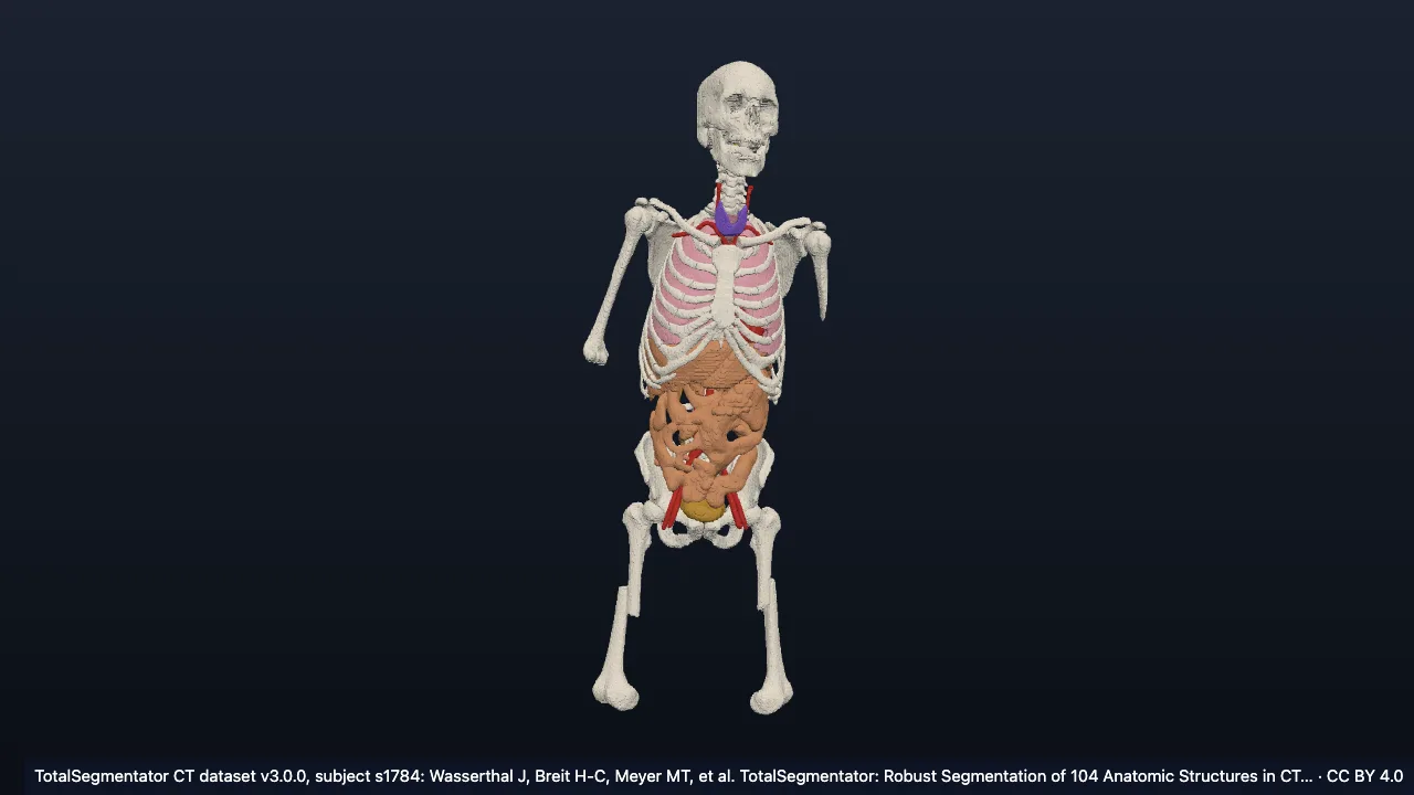 Cross-sectional anatomy: how to read a CT slice