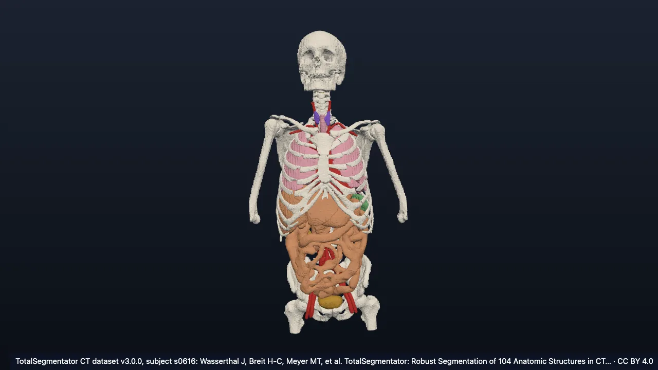 Real CT case s0616: male, 58