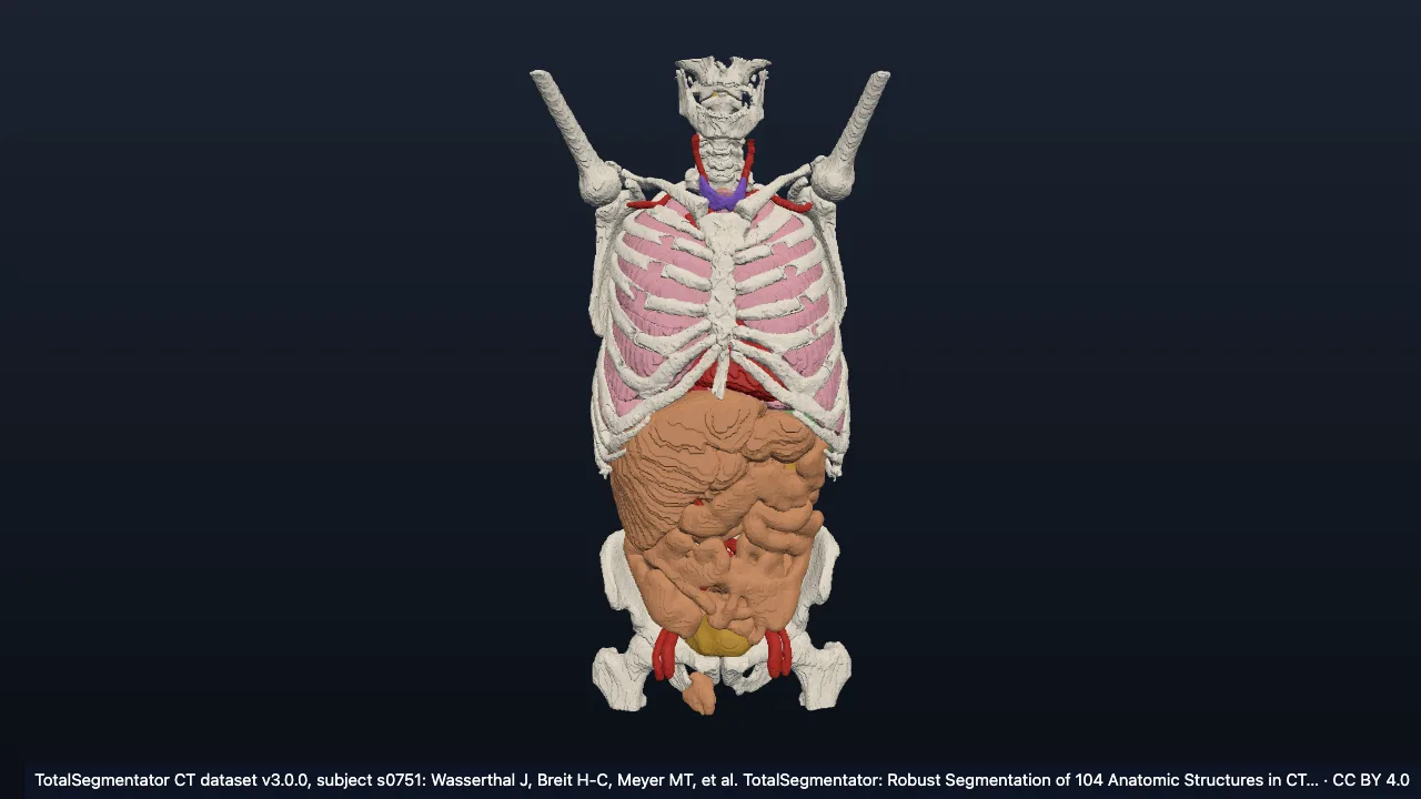 Real CT case s0751: male, 62