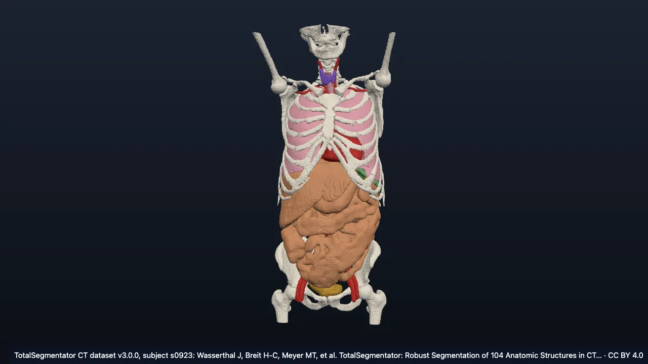 Real CT case s0923: female, 41
