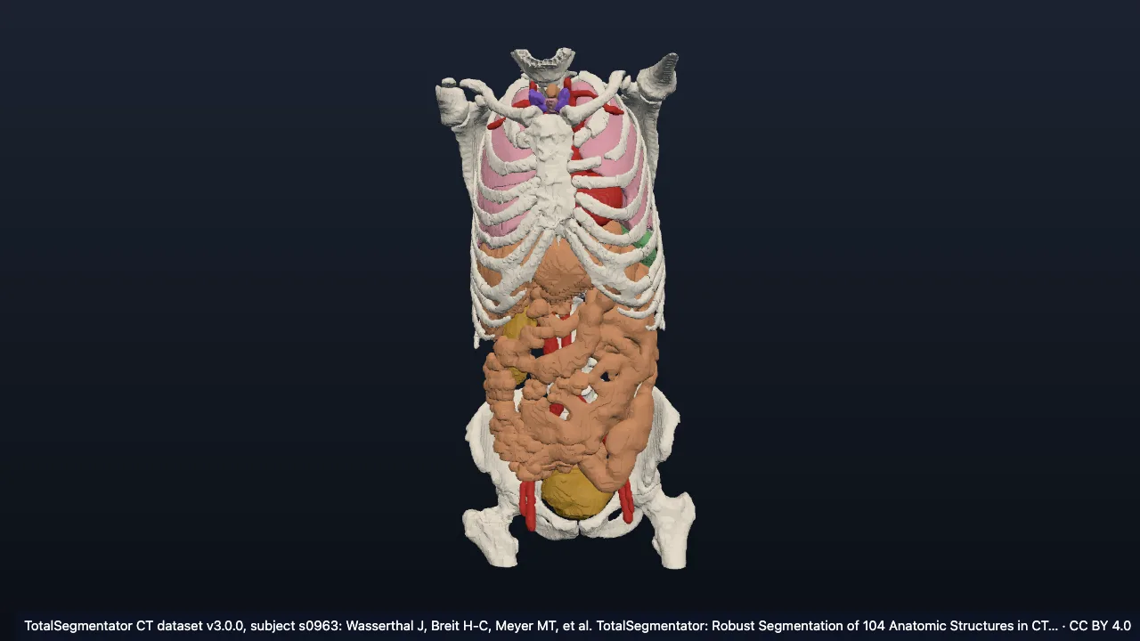 Real CT case s0963: female, 58