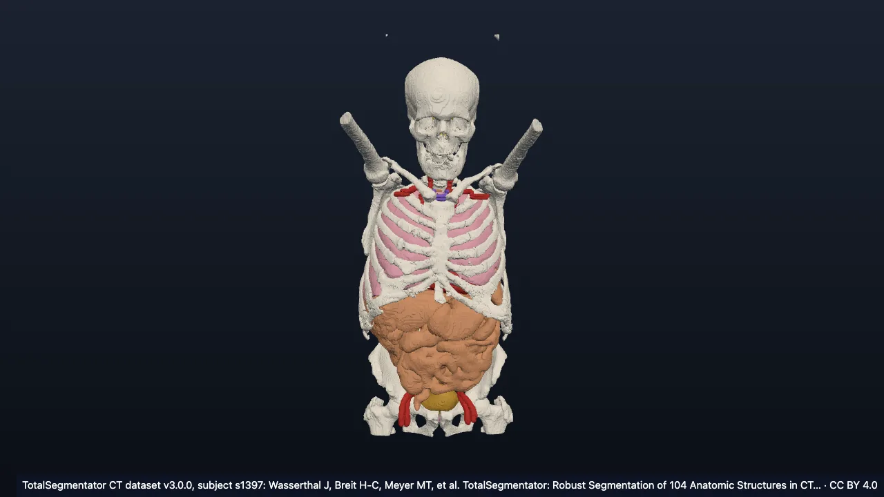 Real CT case s1397: male, 73