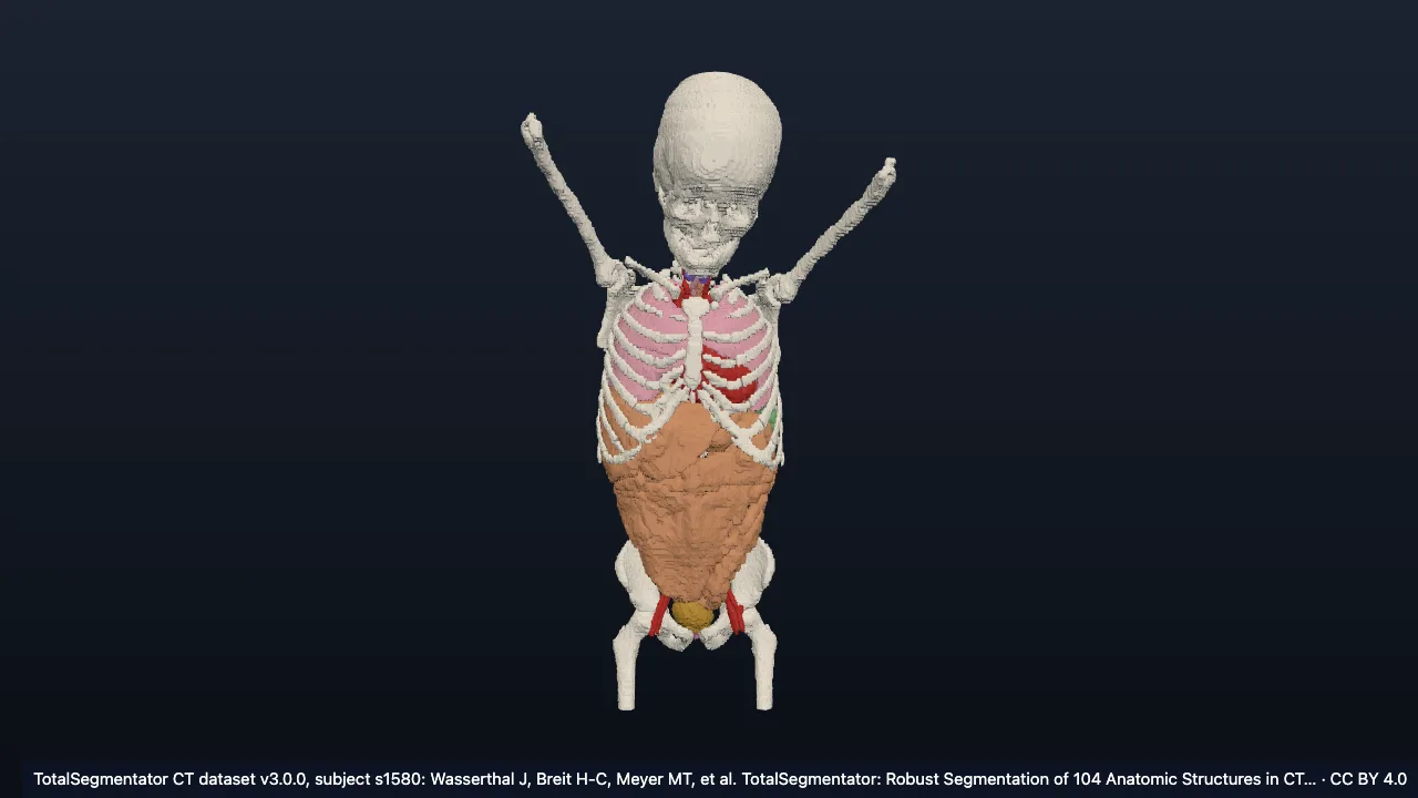 Real CT case s1580: male, 9