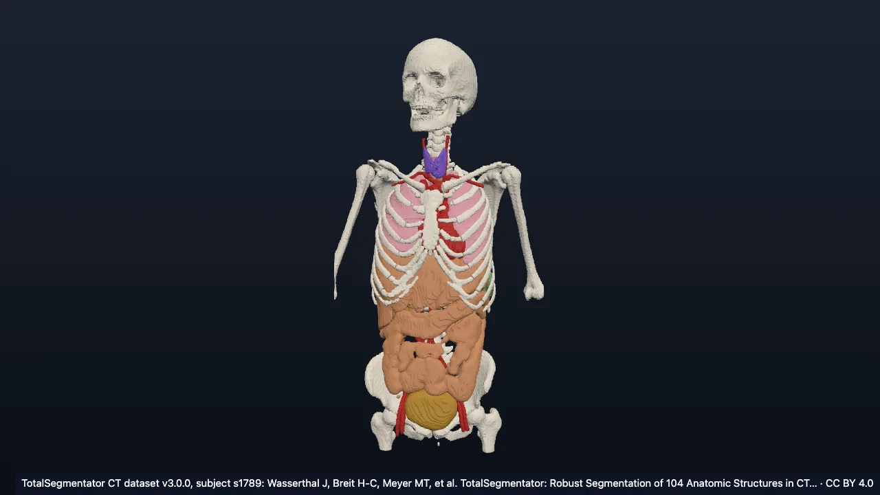 Real CT case s1789: female, 21
