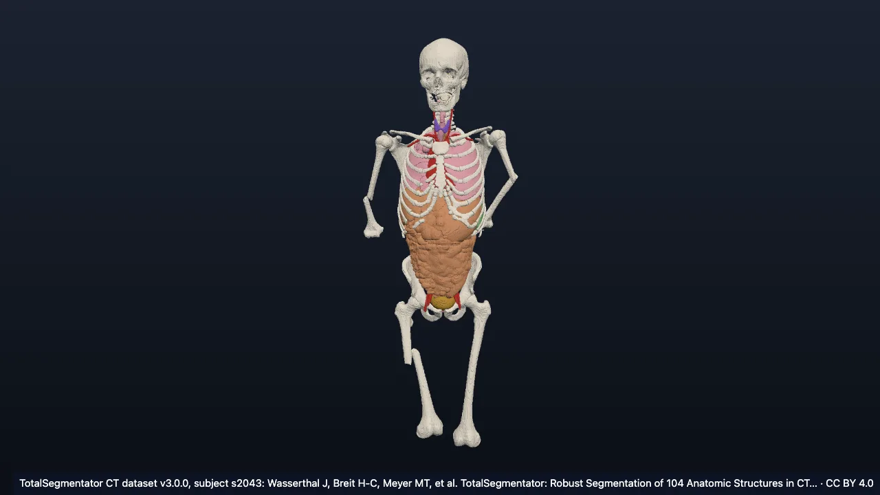 Real CT case s2043: male, 15