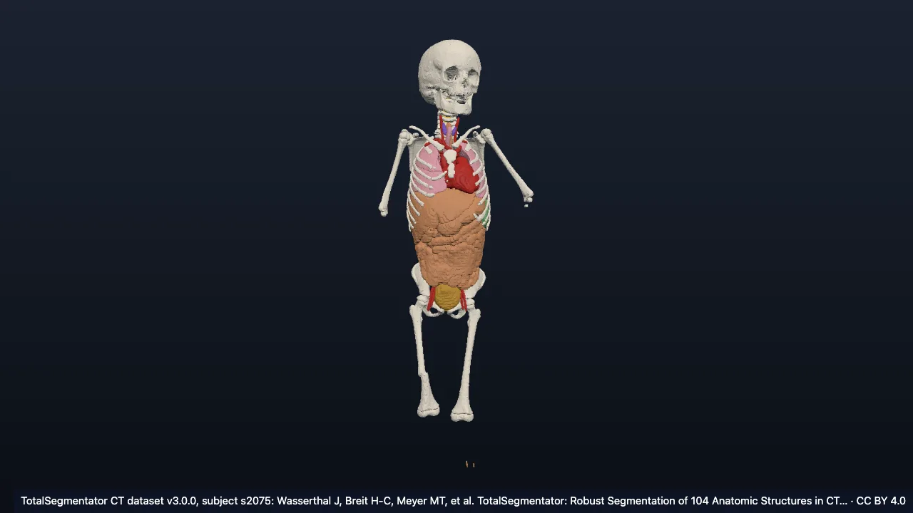Real CT case s2075: female, 5
