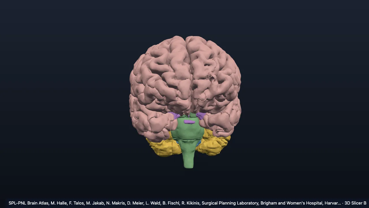 Brain (SPL-PNL atlas)
