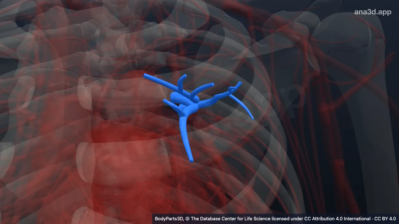 3D model: left anterior segmental artery