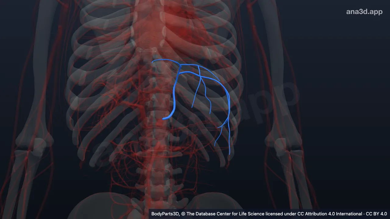 3D model: left inferior phrenic artery