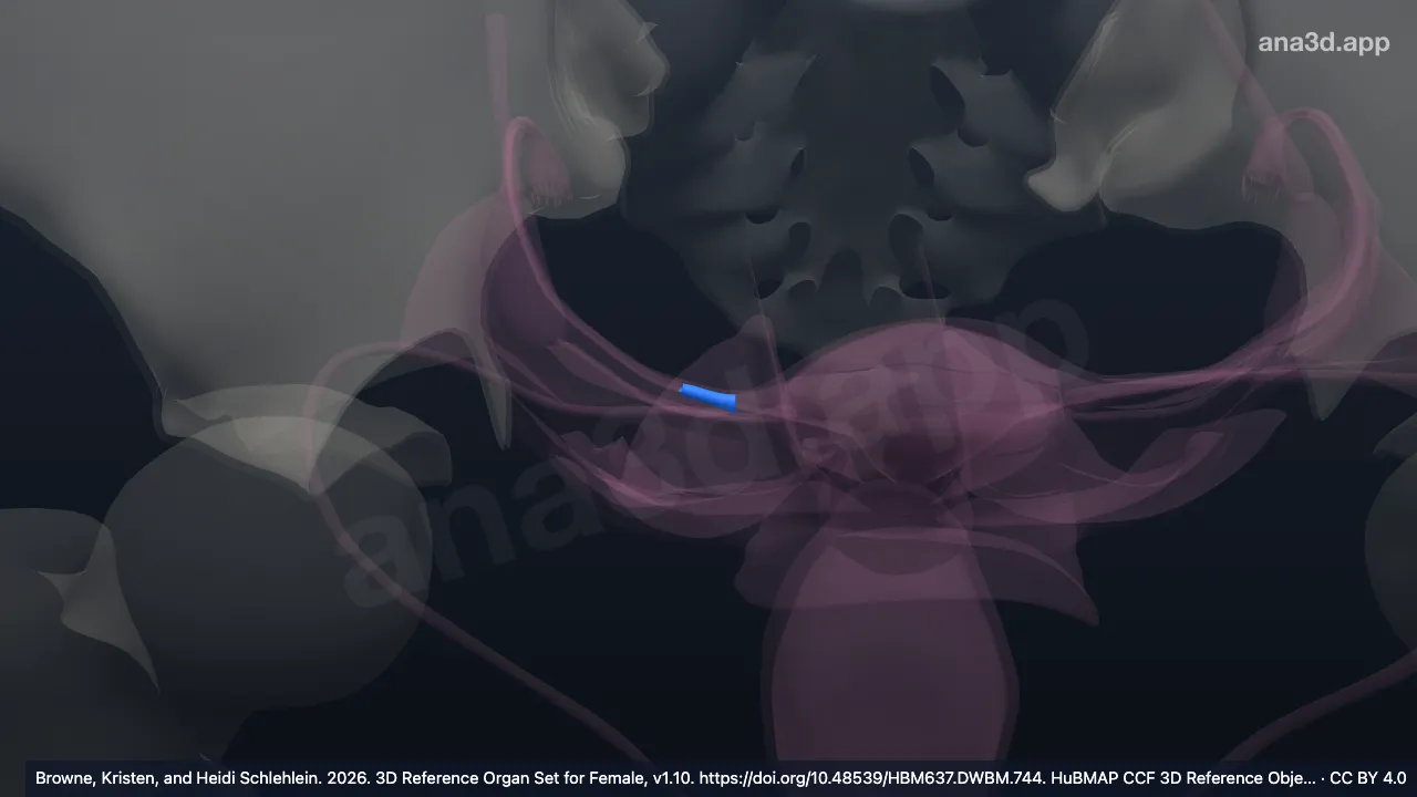 Model 3D: Ismus tuba uterina kanan