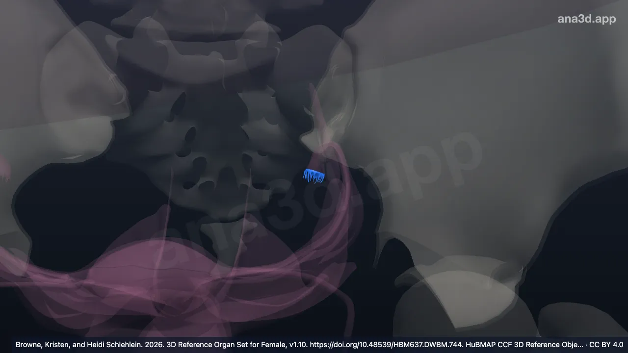 3D 模型：左输卵管伞