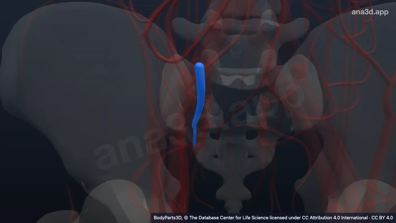 3D model: right internal iliac artery