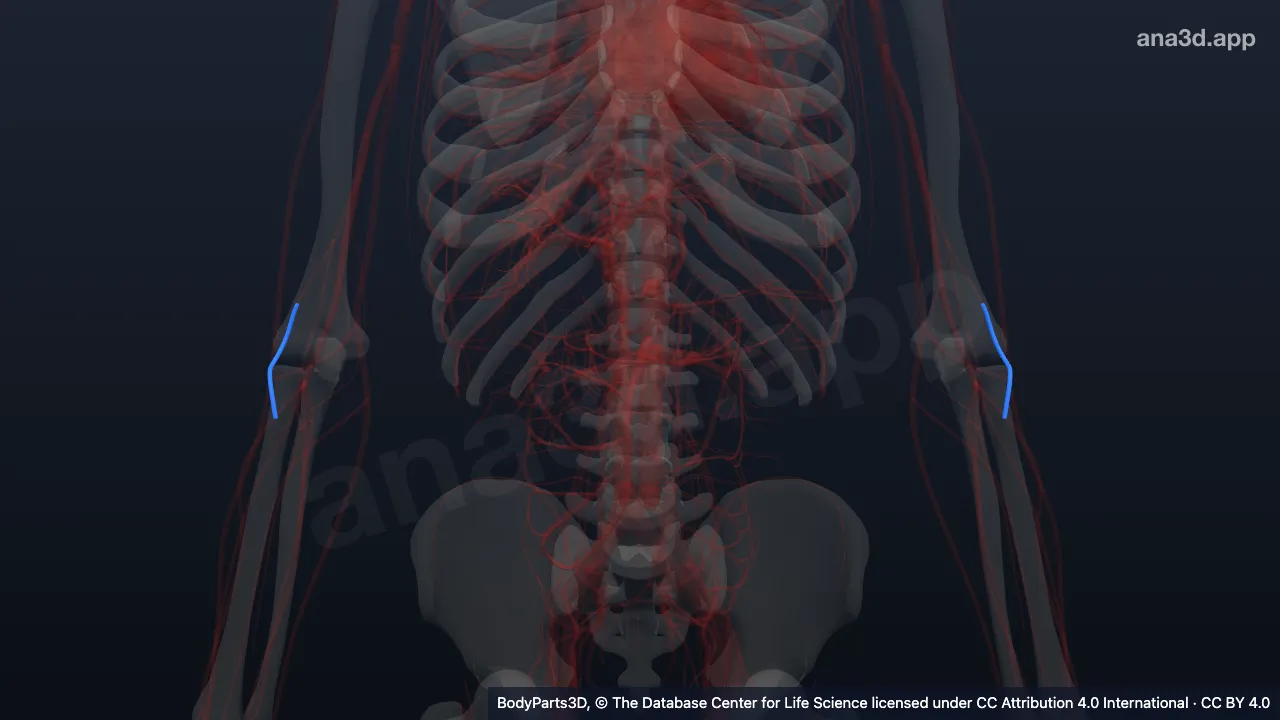3D model: radial recurrent artery