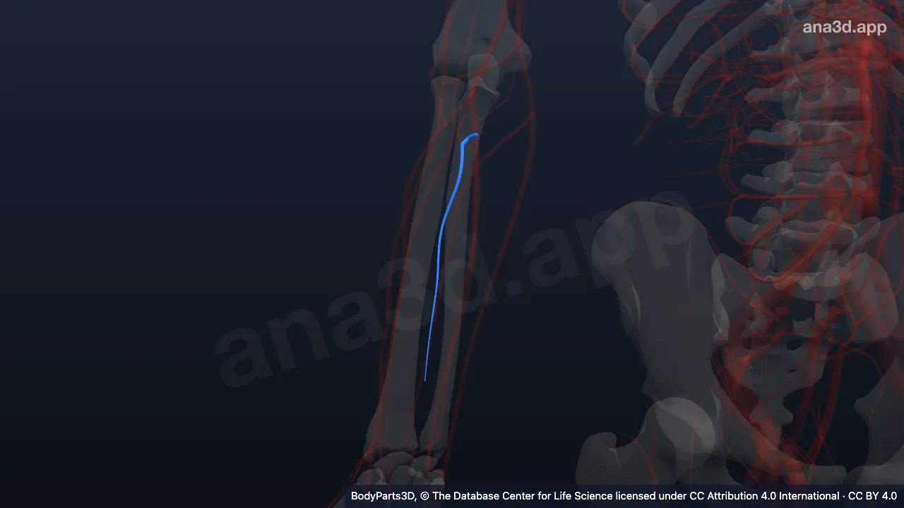 3D model: right common interosseous artery