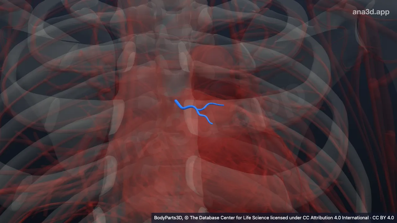 3D model: right conus artery