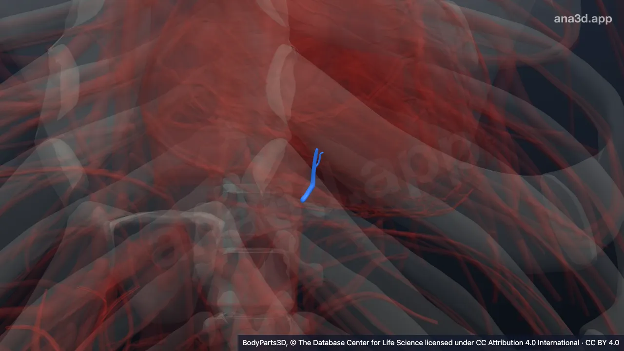 3D-Modell: Zweiter Ramus septalis der rechten Arteria interventricularis posterior