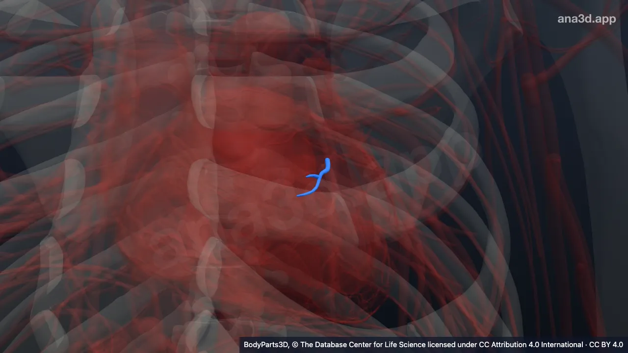 3D model: first right anterior branch of anterior interventricular branch of left coronary artery