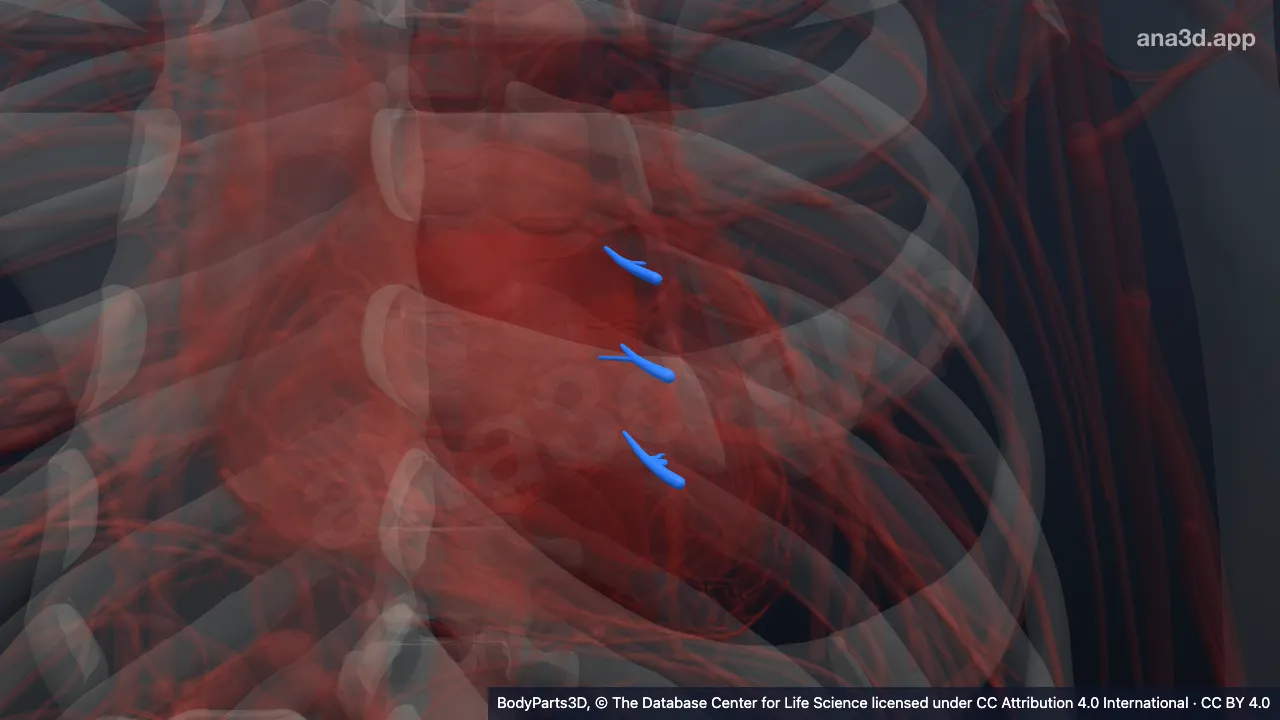 3D-Modell: Ramus septalis der Arteria interventricularis anterior