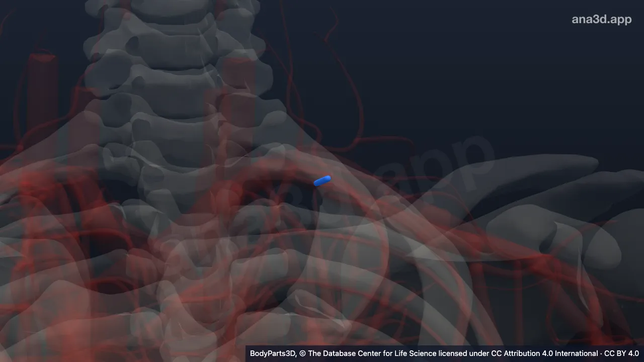 3D model: left superior intercostal artery