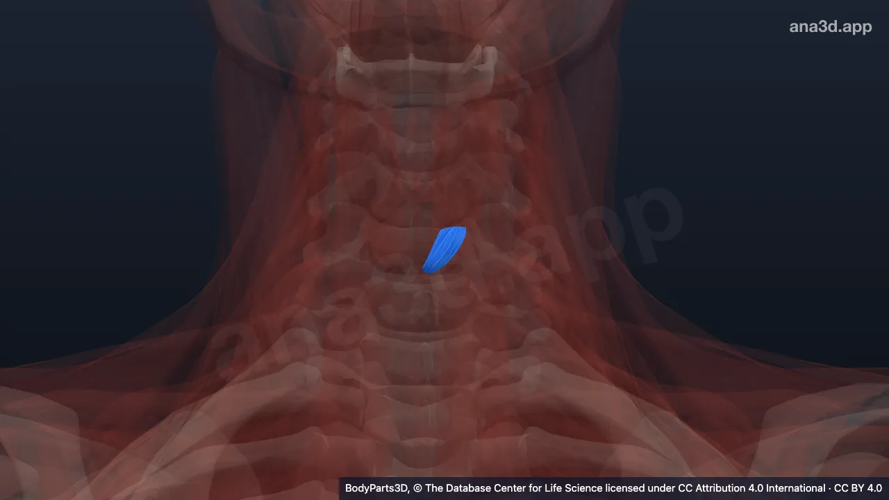 3D-Modell: Pars recta des linken Musculus cricothyroideus