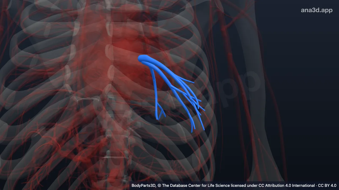 3D model: left inferior pulmonary vein
