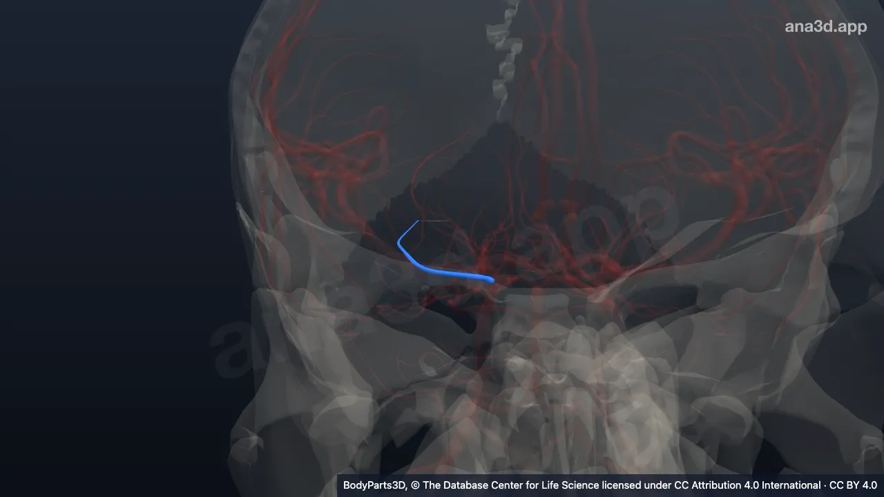 3D-Modell: Rechte Arteria choroidea anterior