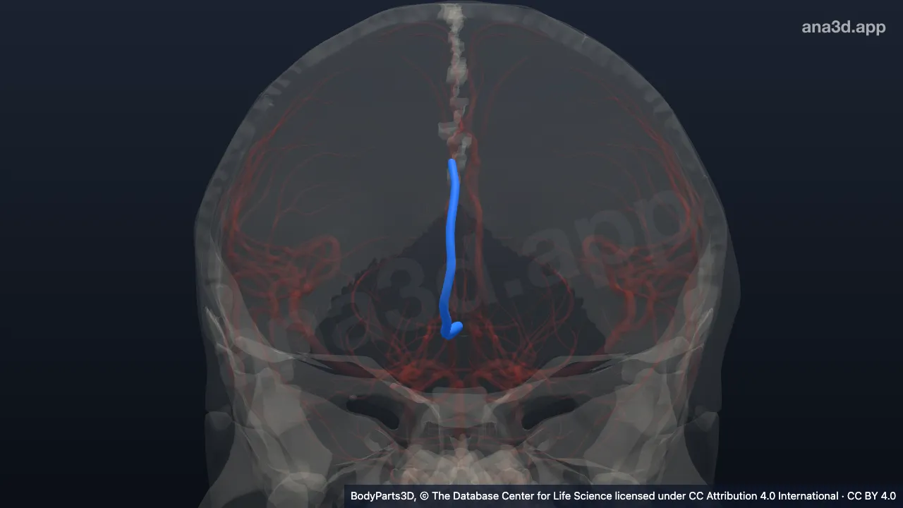 3D model: right callosomarginal artery