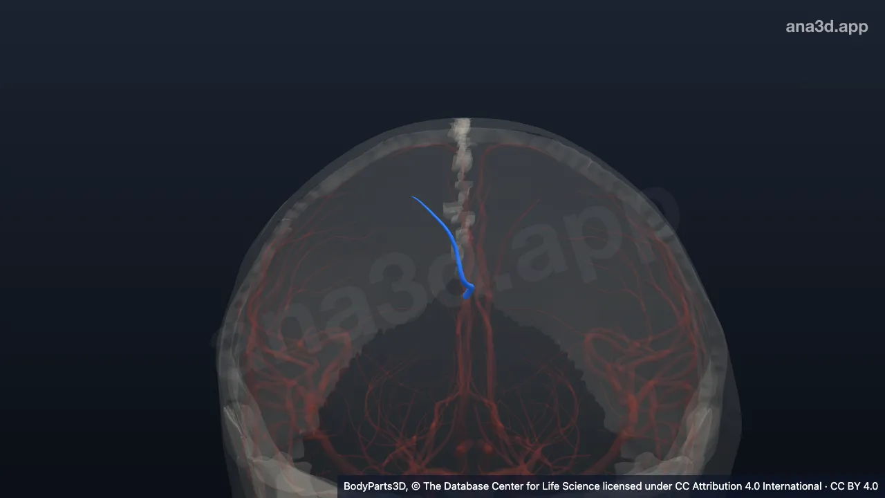 3D model: intermediomedial branch of right callosomarginal artery