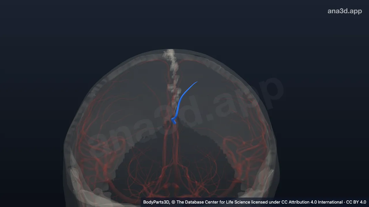 3D model: intermediomedial branch of left callosomarginal artery