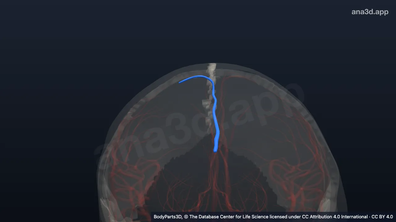 3D model: posteromedial branch of right callosomarginal artery