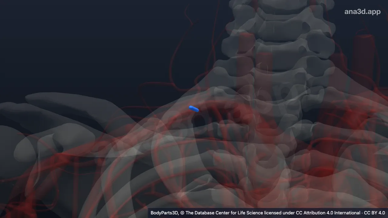3D model: right superior intercostal artery
