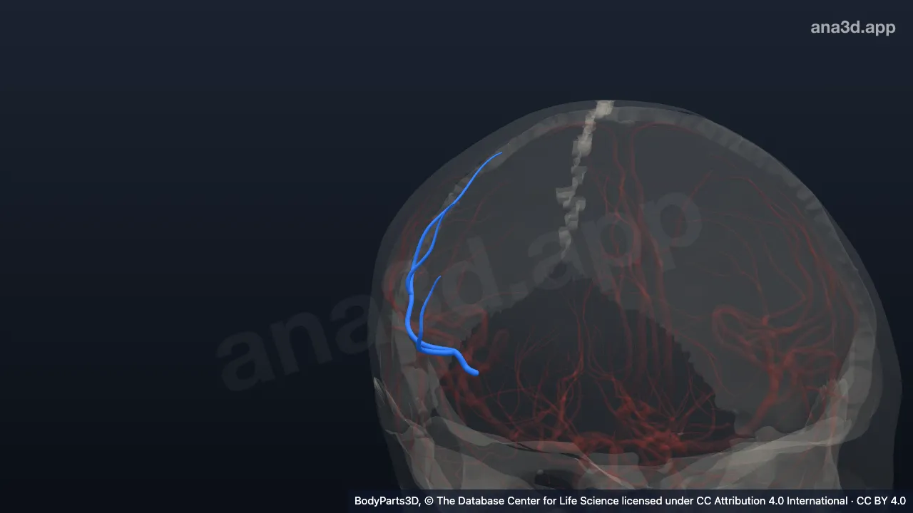 Modelo 3D: Arteria del surco precentral derecho