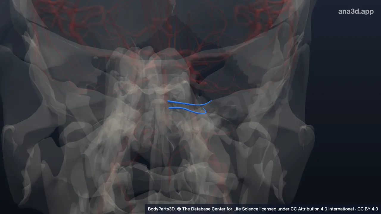 3D model: lateral branch of left pontine artery