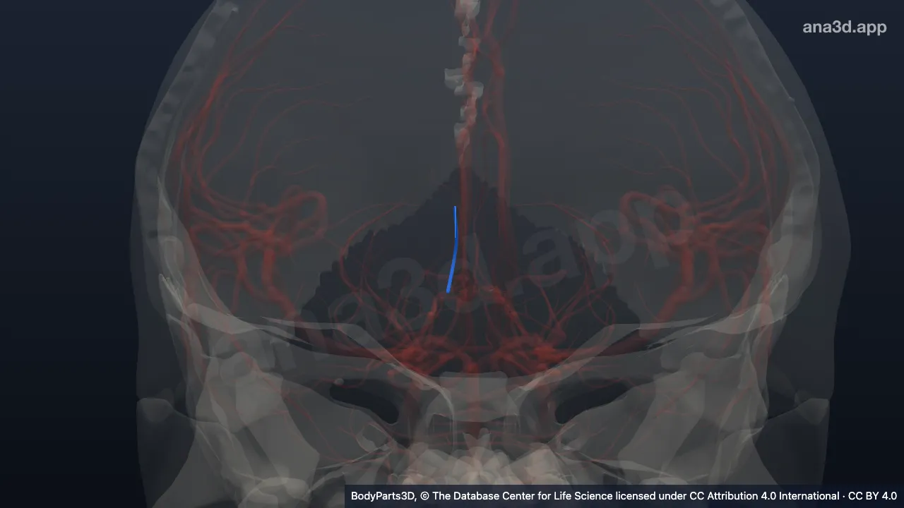 3D model: right posterior choroidal artery