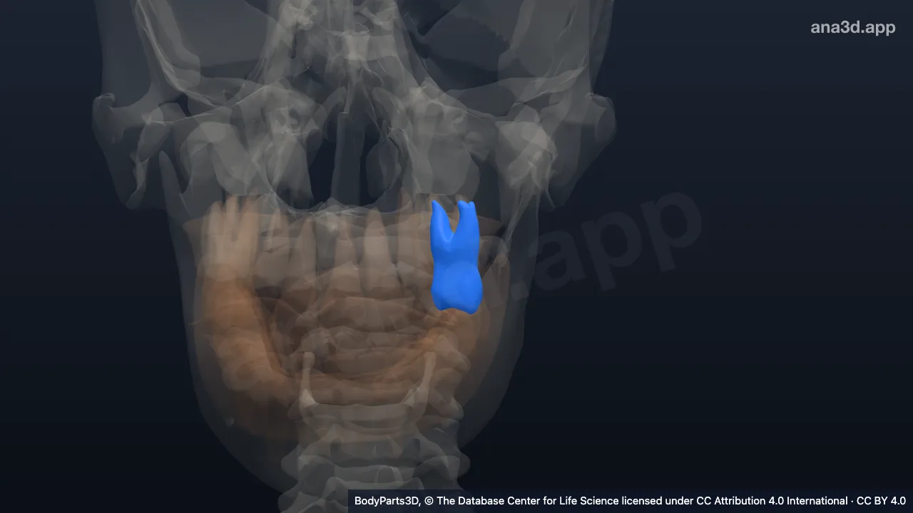 3D 模型：左上颌第1恒磨牙