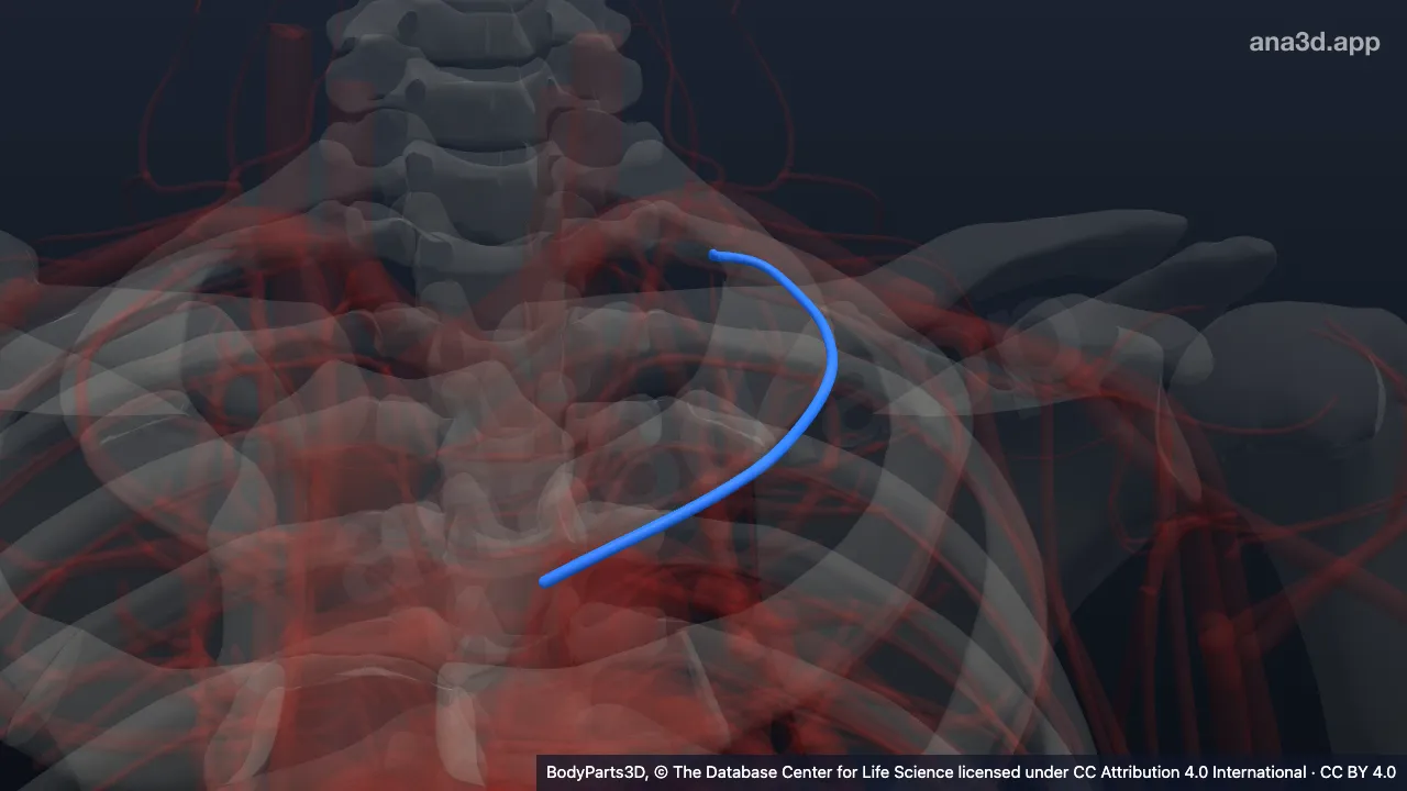 3D model: left first posterior intercostal artery