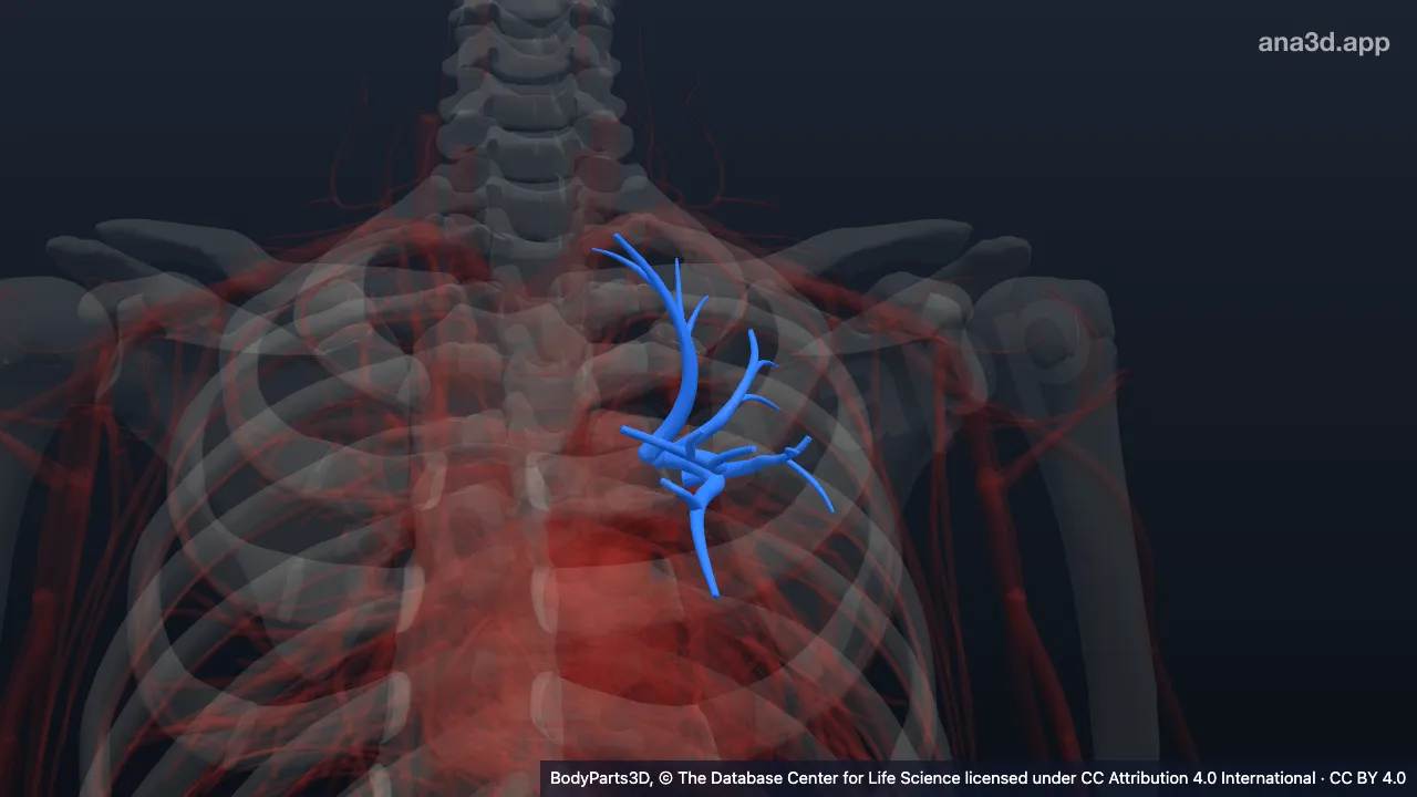 Modelo 3D: Arteria lobar superior izquierda