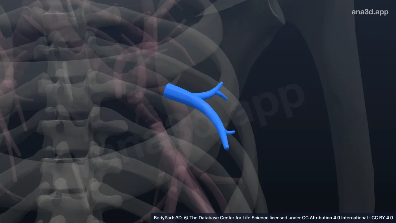 Modelo 3D: Árvore brônquica lingular superior