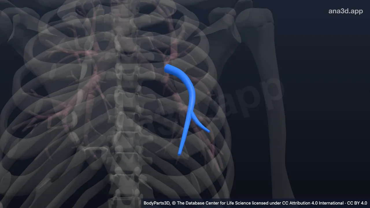 3D model: inferior lingular bronchial tree