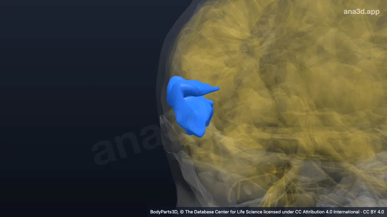 Modelo 3D: Parte posterior do giro temporal superior direito
