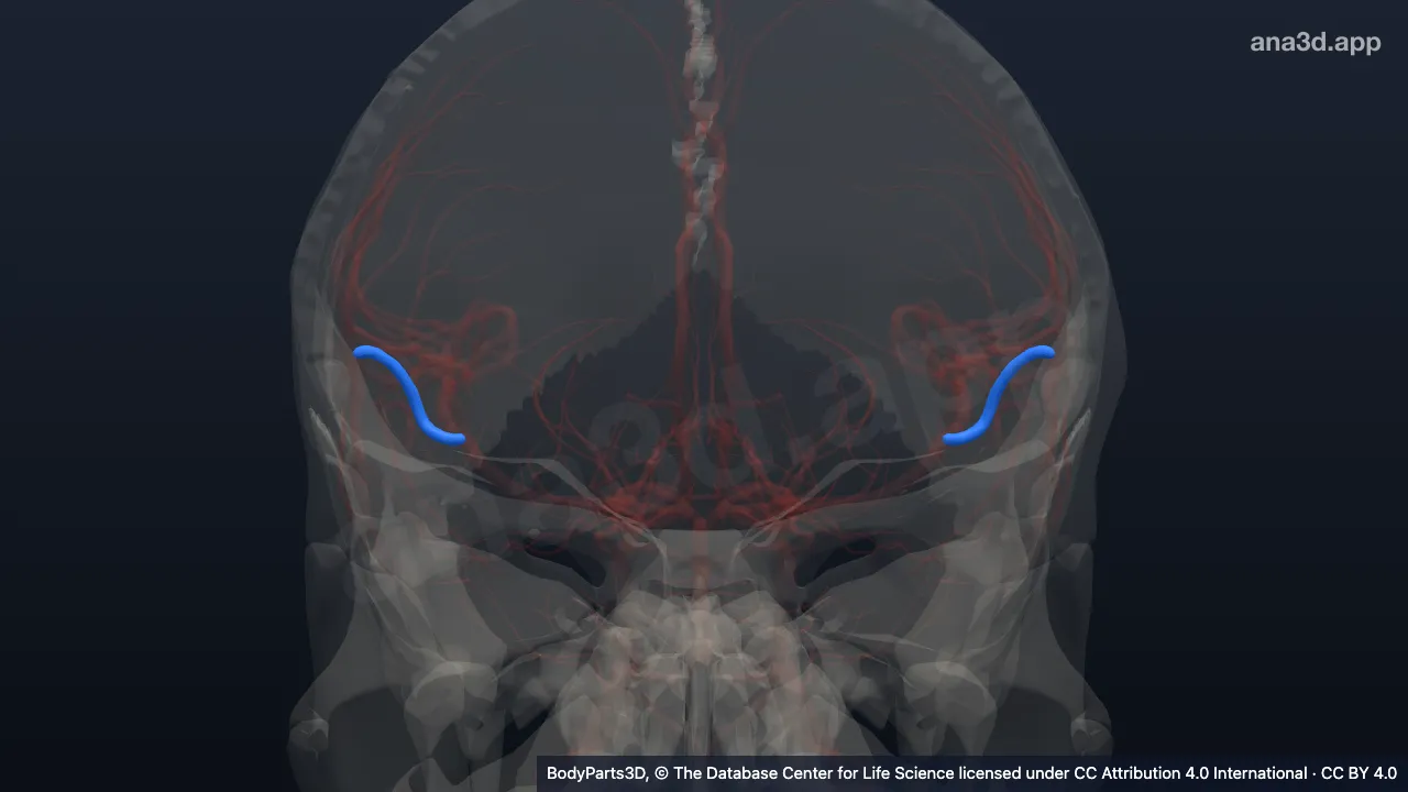 3D model: trunk of branch of middle cerebral artery