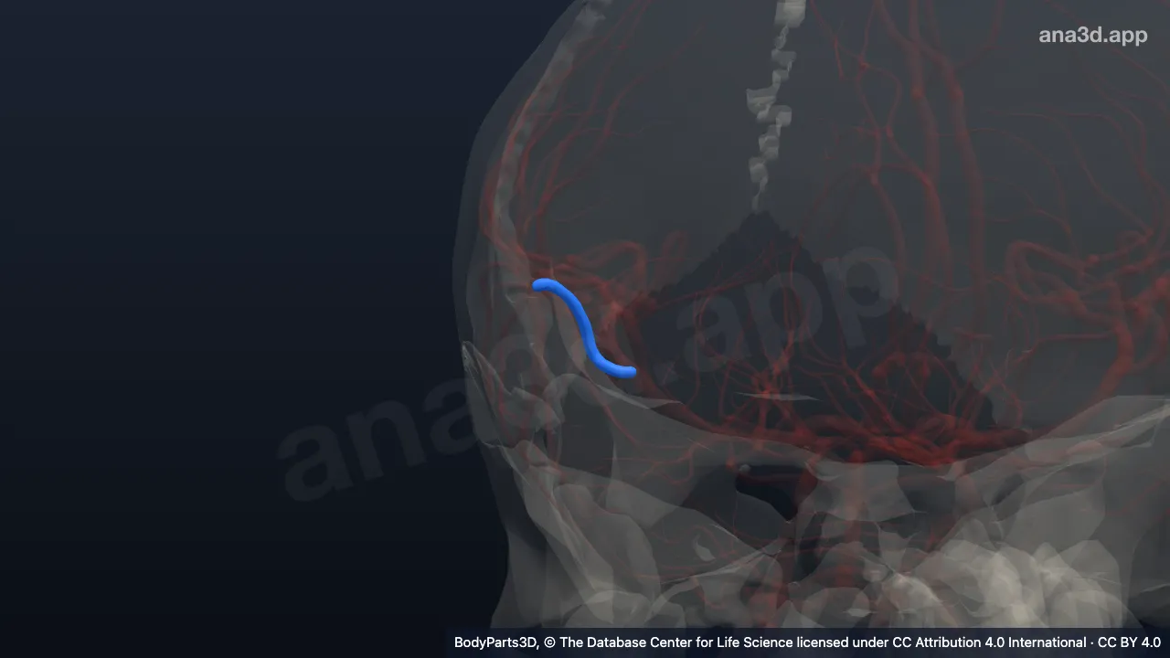 3D model: trunk of inferior terminal branch of right middle cerebral artery