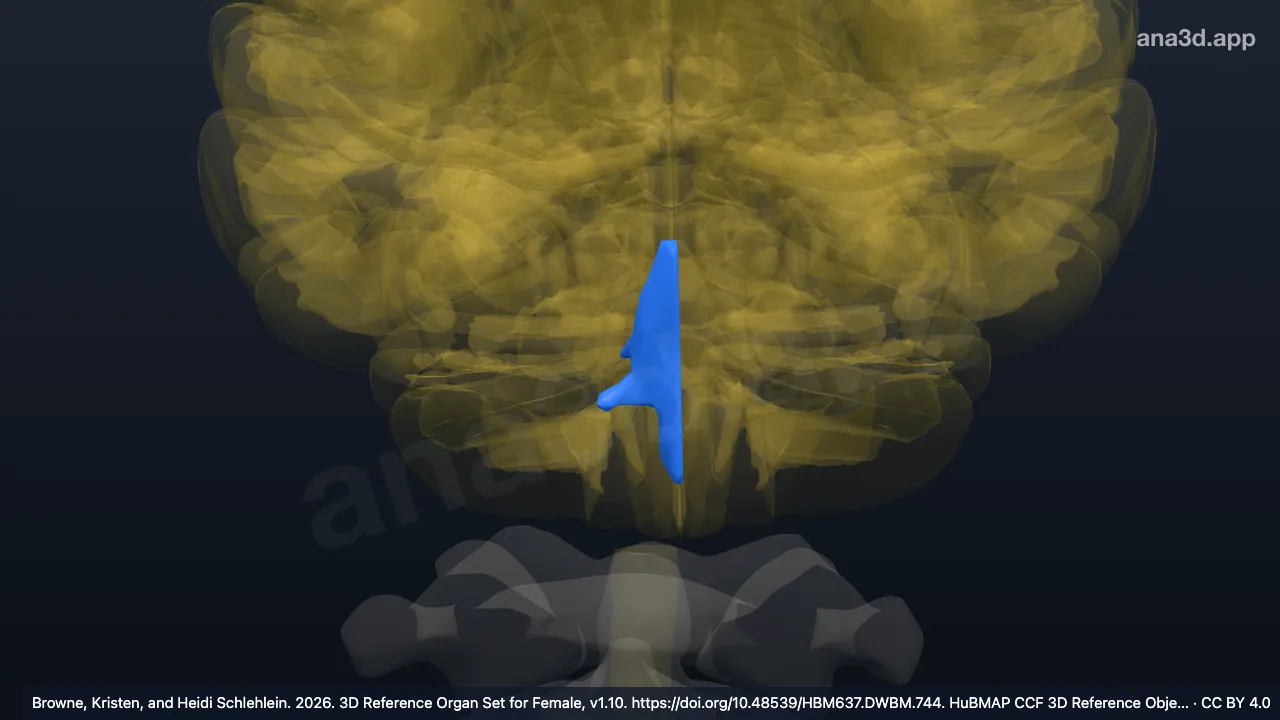 Modelo 3D: Cuarto ventrículo derecho