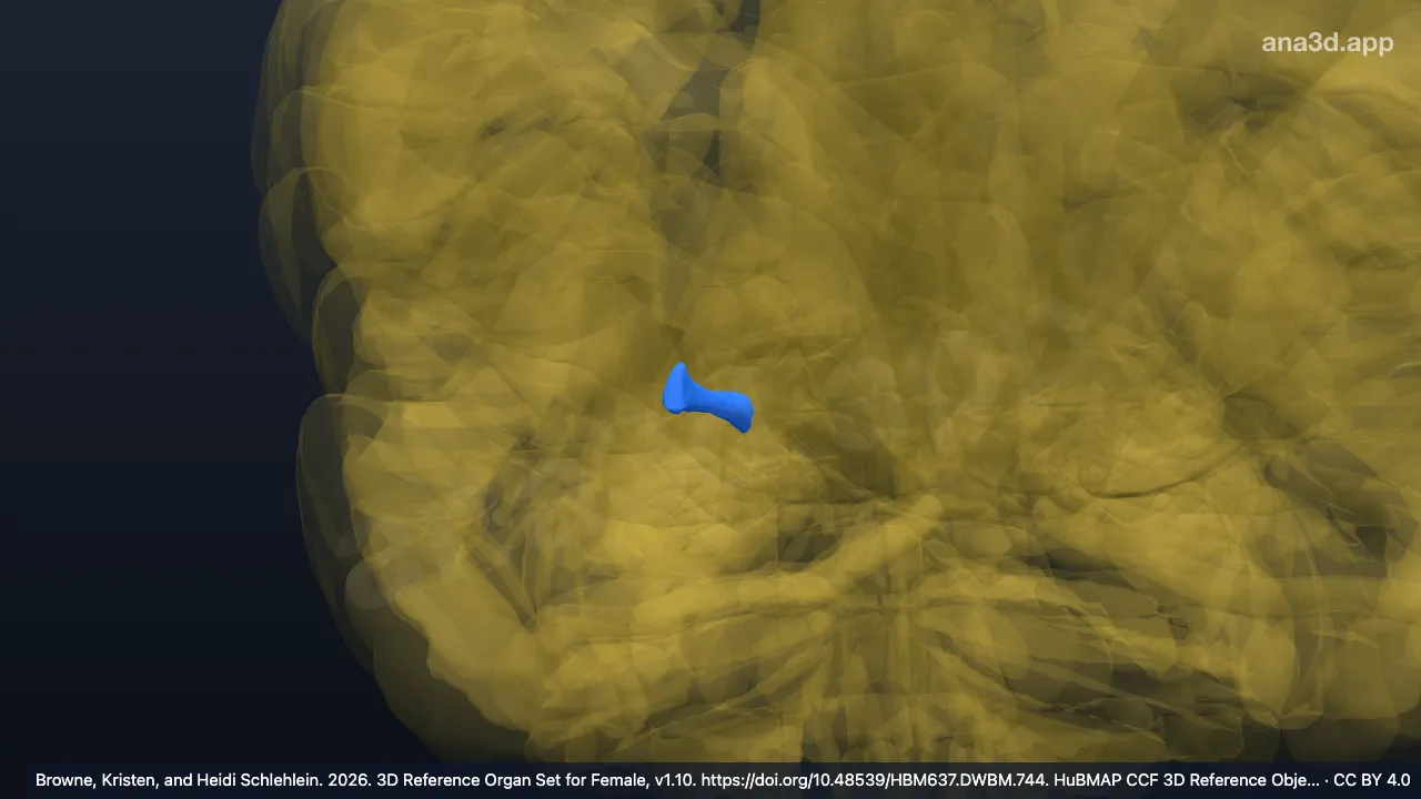 Modelo 3D: Cuerno posterior del ventrículo lateral derecho