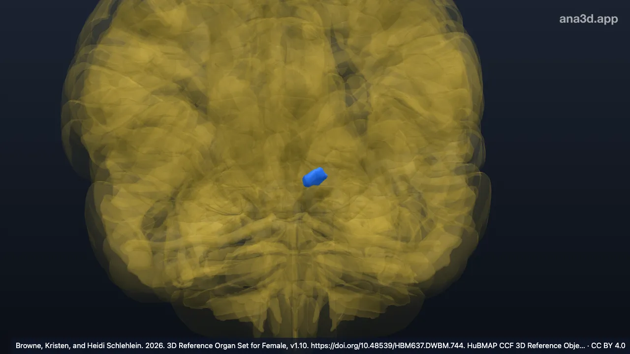 Model 3D: Nukleus subtalamikus kiri