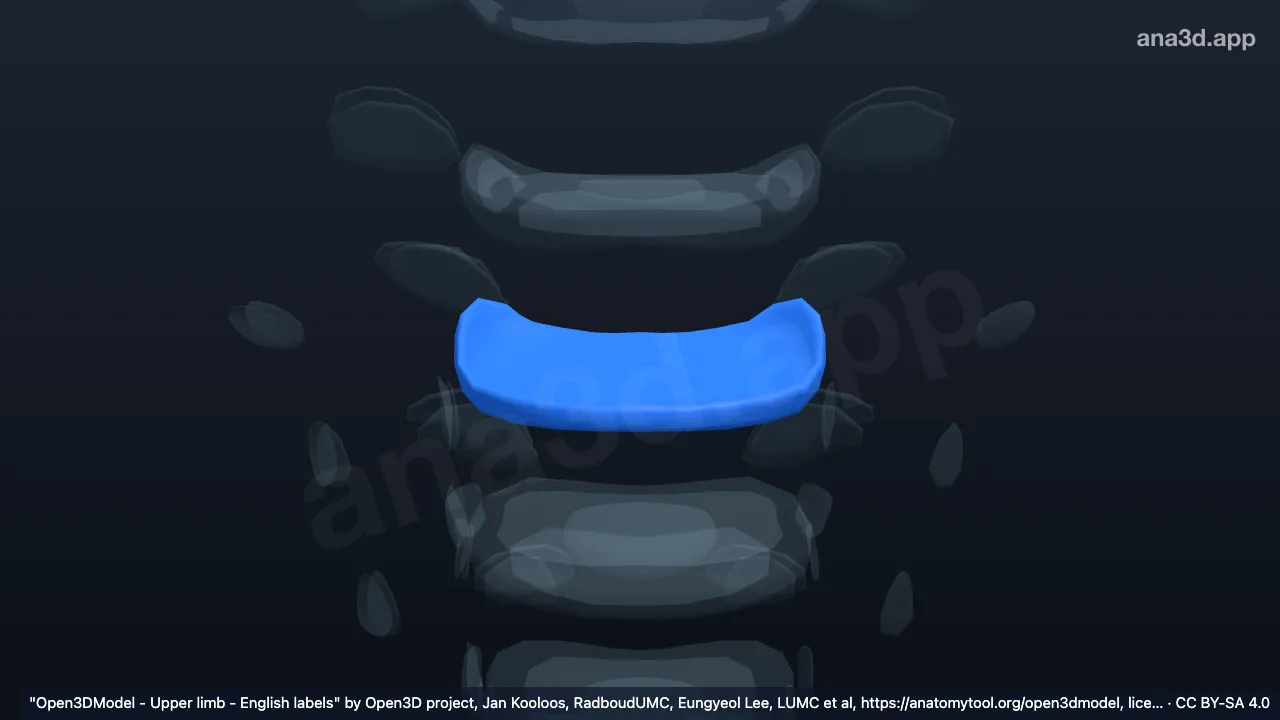 Modelo 3D: Anel fibroso C7 T1