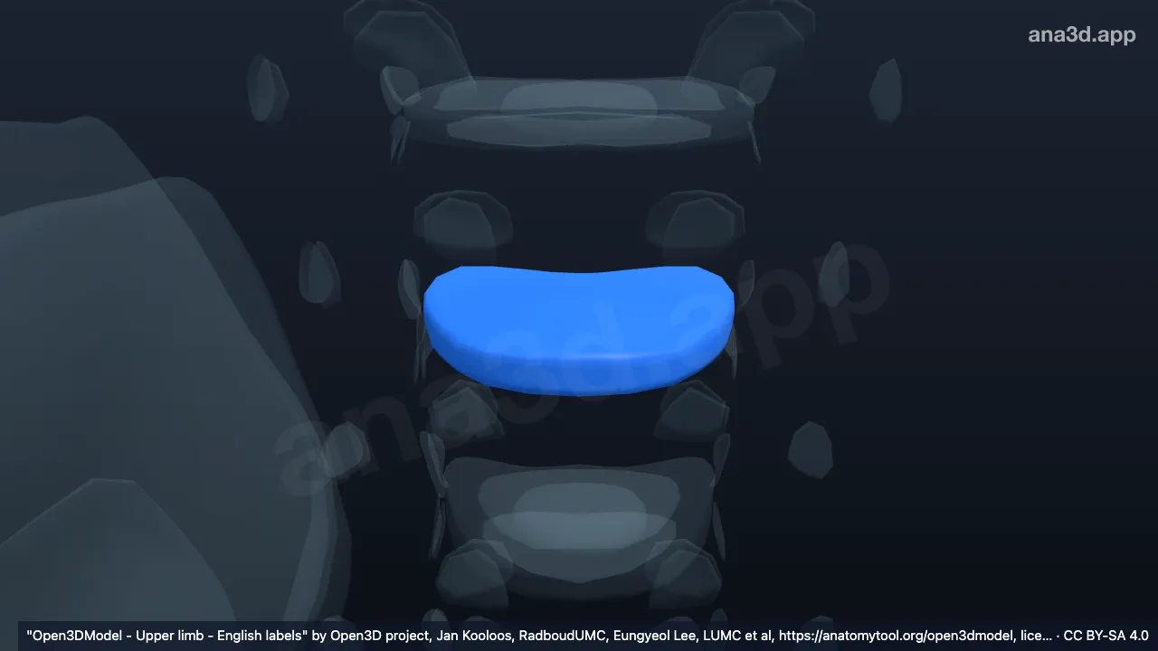 Modelo 3D: Anel fibroso T2 T3