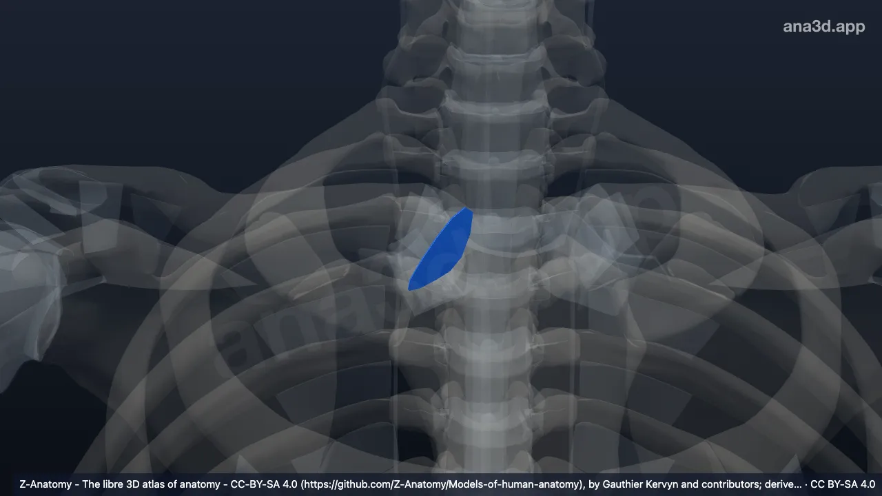 3D-Modell: Discus articularis der rechten Articulatio sternoclavicularis