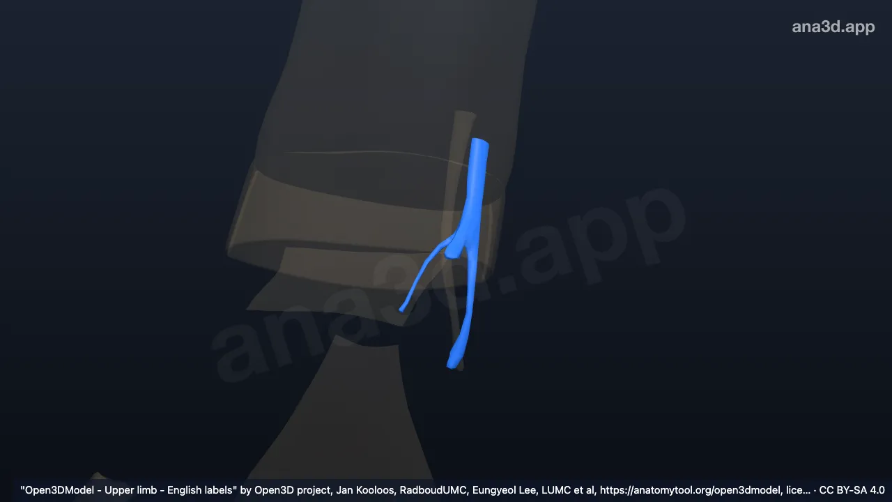 3D 模型：右尺侧腕屈肌总腱