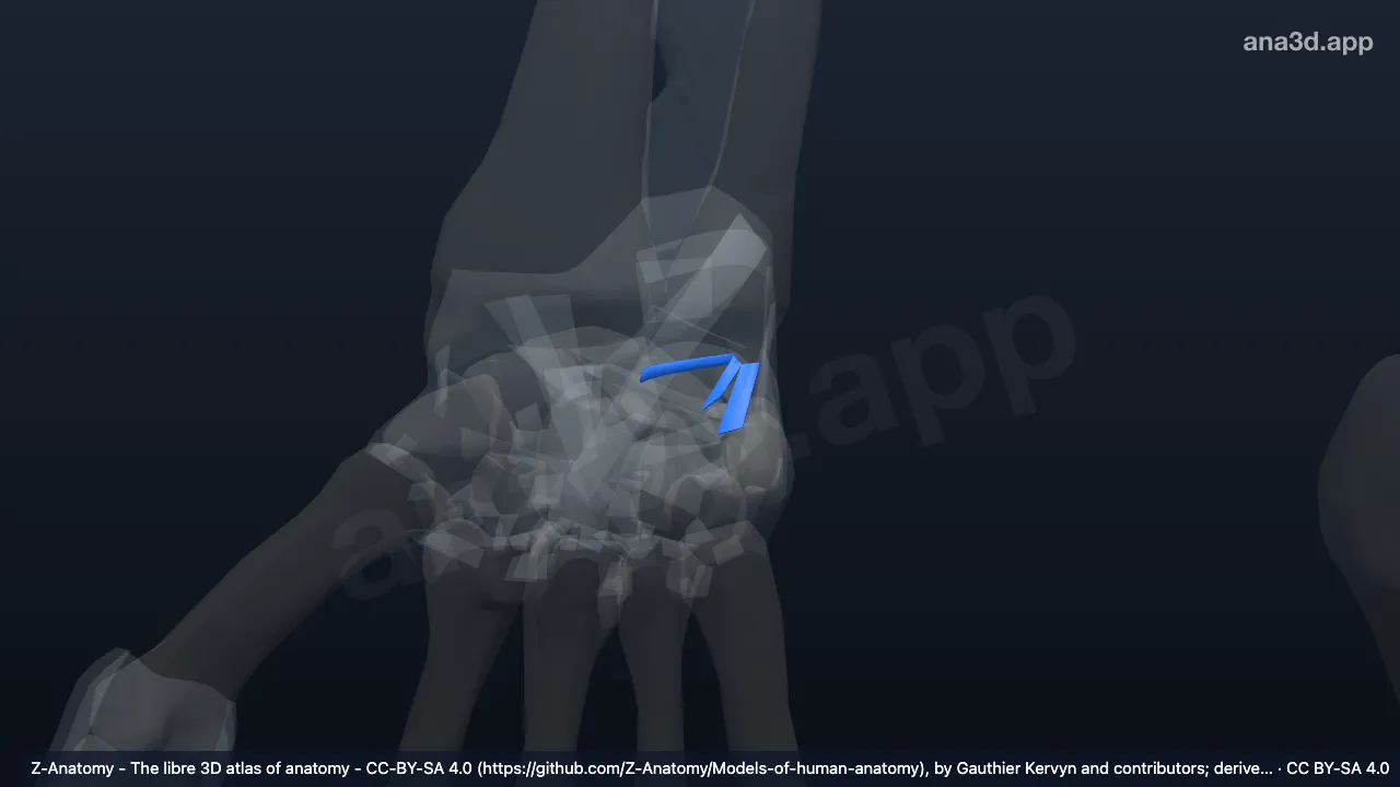 3D model: right dorsal ulnocarpal ligament